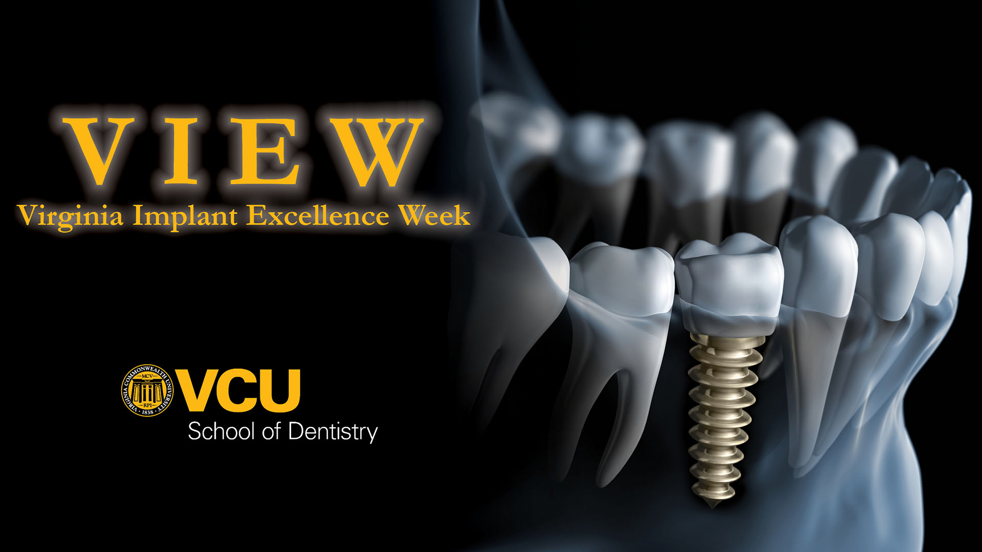 VCU School of Dentistry to host Virginia Implant Excellence Week in November